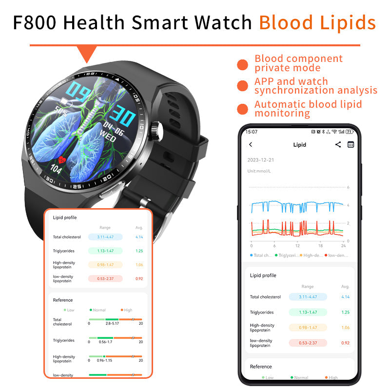2025 New Accurate Measure ECG+PPG Diabetic Watches for Women Men Full Touch Screen Sport Fitness Watches Bluetooth For Android ios Smartwatch-3